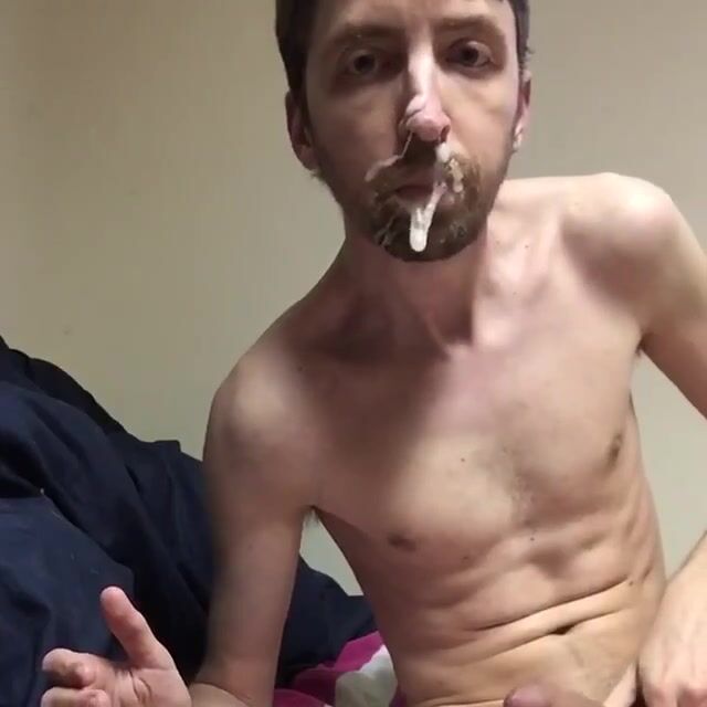 Garoto mal em cio se alimenta sozinho