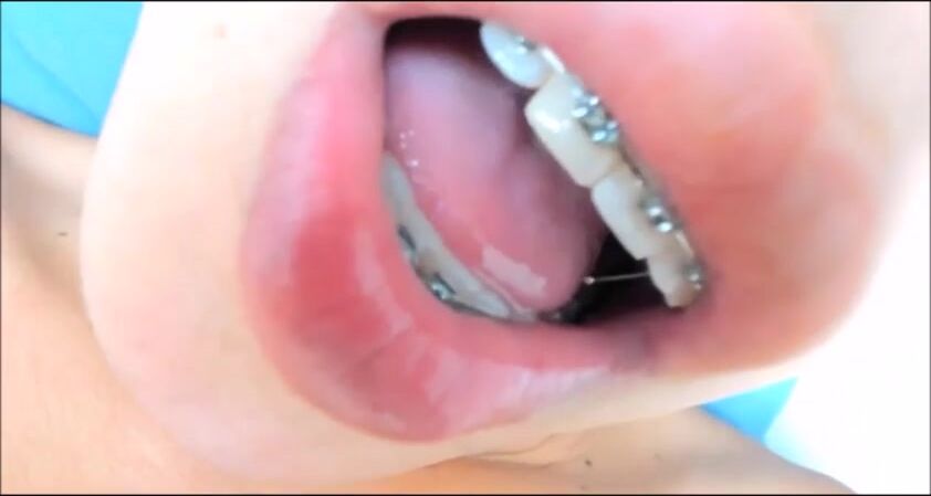 Latino braces guy eats cum - rubax video